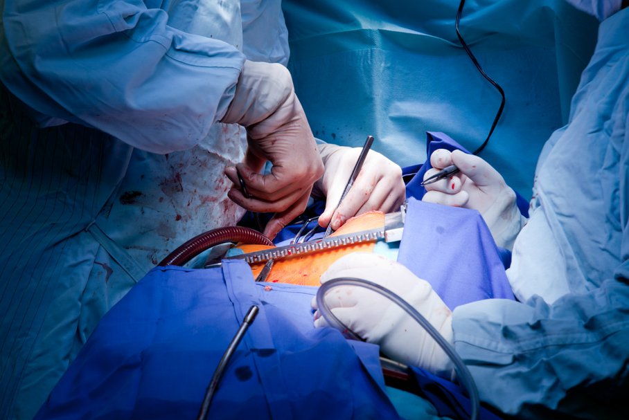 Operacja tętniaka aorty - objawy i sposoby przeprowadzania zabiegu