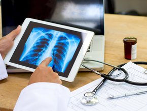 Pneumocystis – diagnostyka i badania