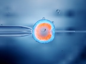 Procedura zapłodnienia in vitro