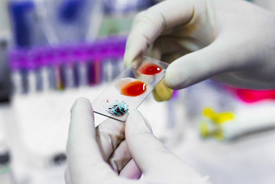 Zjawisko aglutynacji jest od dawna wykorzystywane w serologii jako podstawa badania grupy krwi.