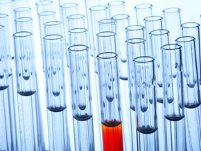 Antybiogram (badanie bakterii na oporność na antybiotyki) – wskazania, przebieg, wyniki