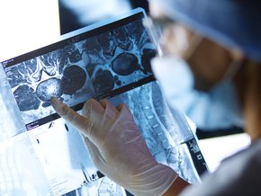 środek kontrastujący w radiologii