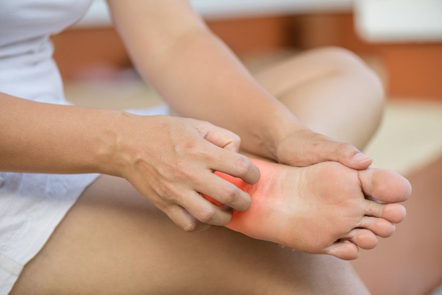 Swędzące stopy – jakie mogą być przyczyny? Czy to objaw grzybicy stóp?