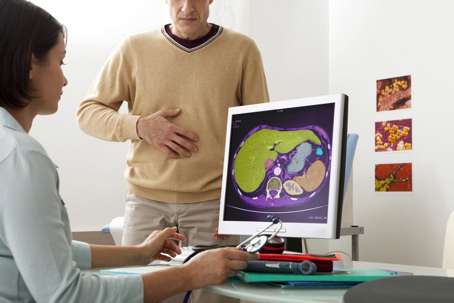 Lekarz oglądająca zdjęcie tomograficzne brzucha pacjenta.