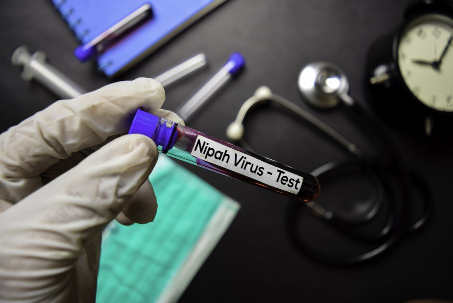 Wirus Nipah – co o nim wiemy, czy nam zagraża?