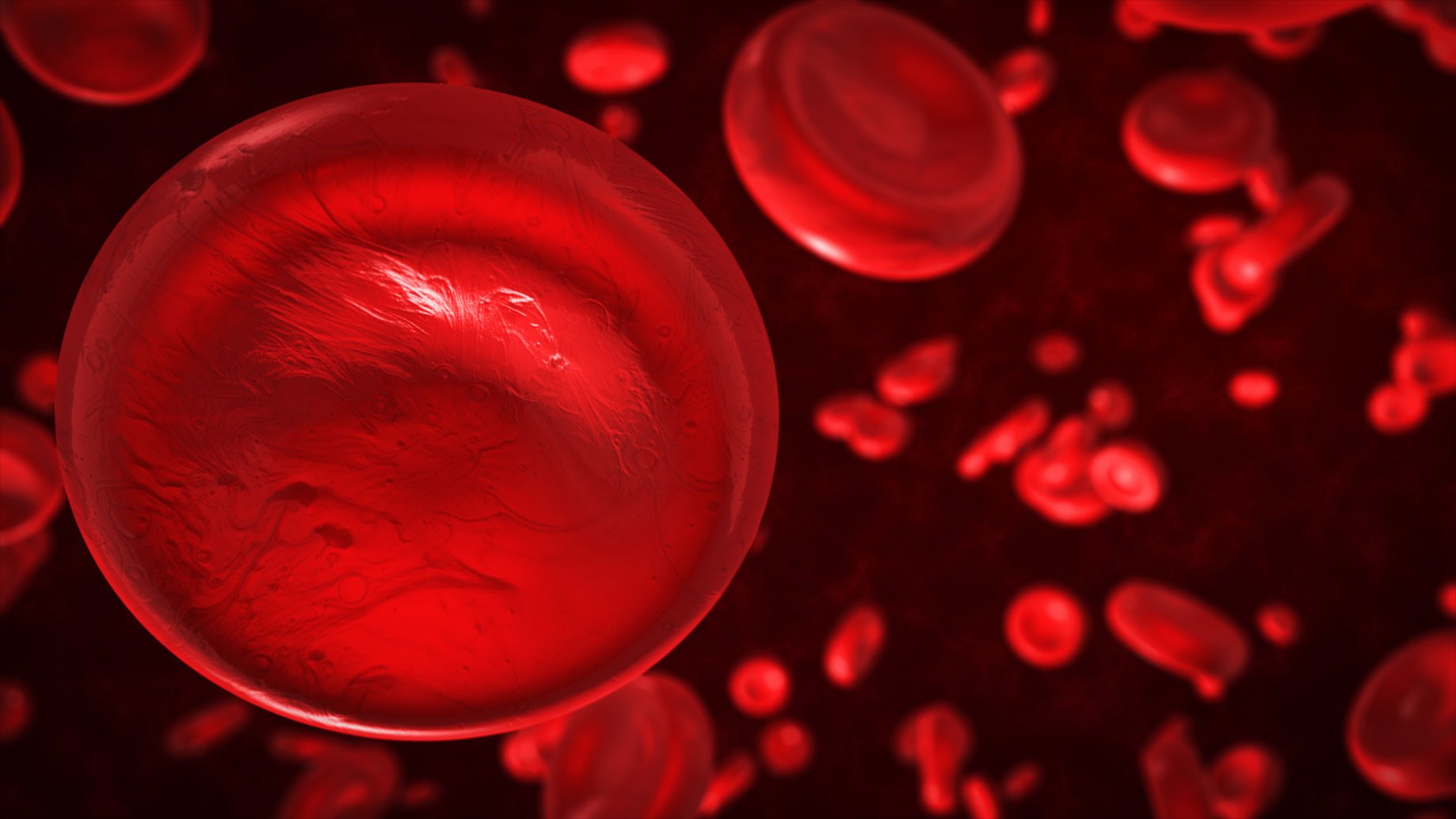 Анемия 18. Эритроциты в крови анемия. Жидкая кровь это анемия. Анемия иллюстрация.