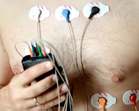 holter EKG