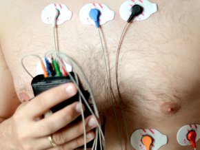 holter EKG