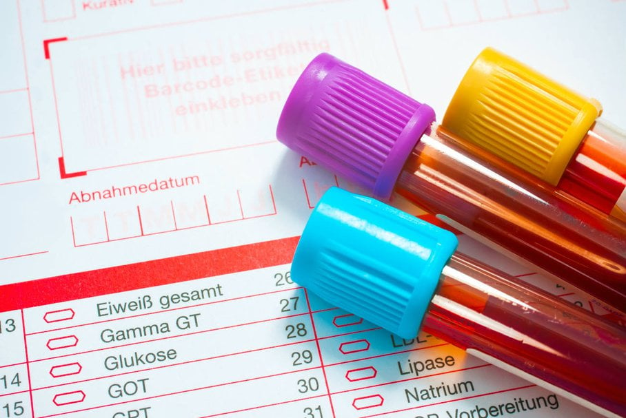 Badanie cholesterolu – wskazania, przebieg, normy i interpretacja wyników