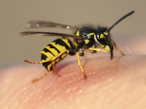 uczulenie na jad owadów