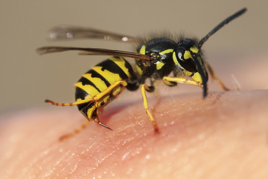 Uczulenie na jad owadów – objawy i leczenie alergii na jad owadów
