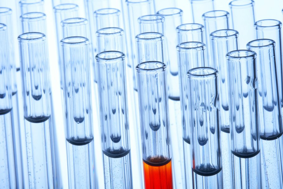 Fosfataza alkaliczna (ALP) – badanie, normy i wyniki