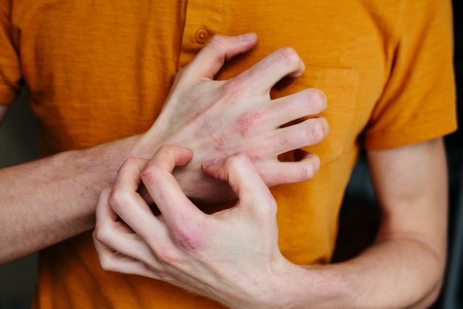 Swędząca wysypka na rękach  – jakie przyczyny mogą mieć uciążliwe krostki na rękach?