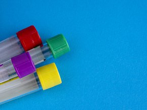 Co to jest monocytoza – objawy, przyczyny, leczenie