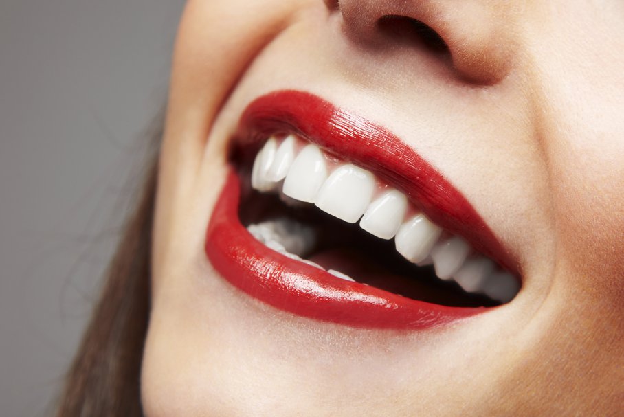 Licówki – co to jest, rodzaje, jak się je zakłada, czy niszczą zęby?