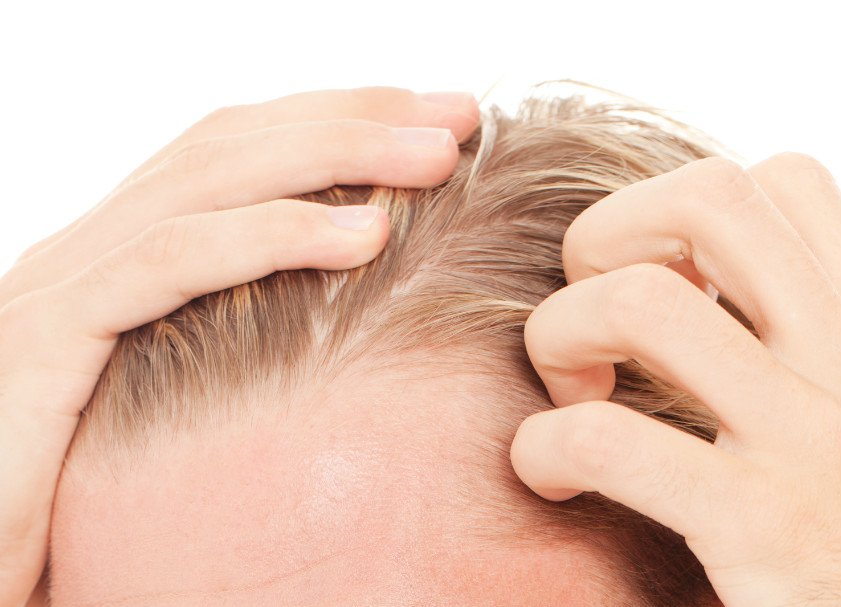 Zapalenie mieszków włosowych – przyczyny, objawy, leczenie