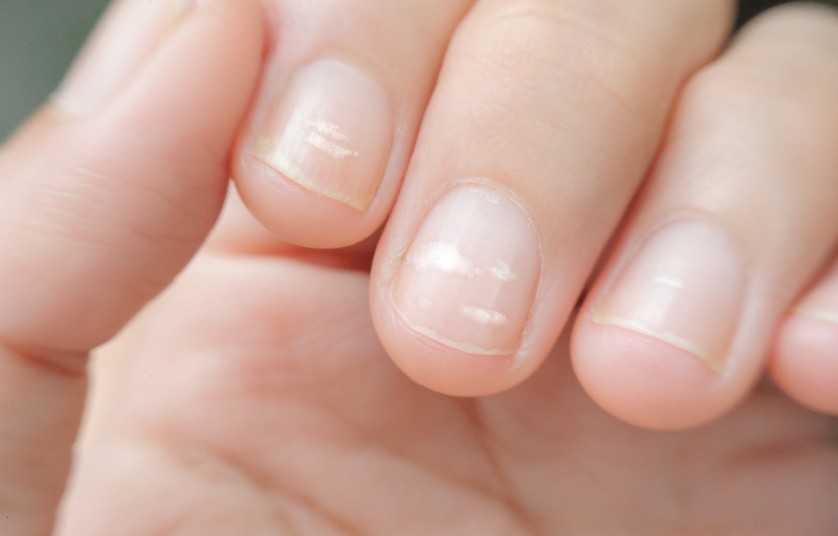 bruzdy na paznokciach jakie sa przyczyny pofalowanej plytki paznokcia wylecz to nicole diary stamping plates matte nail art
