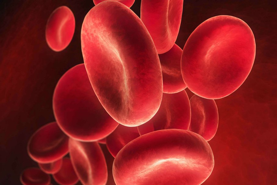 Czerwienica prawdziwa – objawy, powikłania, leczenie i rokowanie