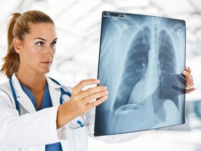 Zapalenie płuc – objawy i leczenie antybiotykiem i domowymi sposobami