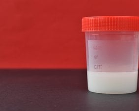 Plastikowy pojemnik wypełniony nasieniem.