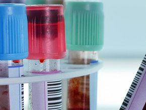Enolaza – neuroswoista enolaza NSE