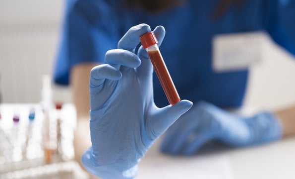 niski poziom hemoglobiny