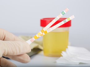 Paski ketonowe – co to jest, jak używać i ile kosztują?