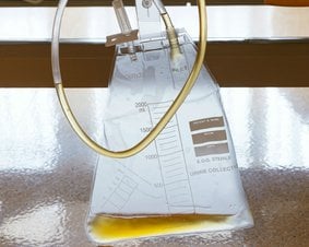 Cystografia mikcyjna