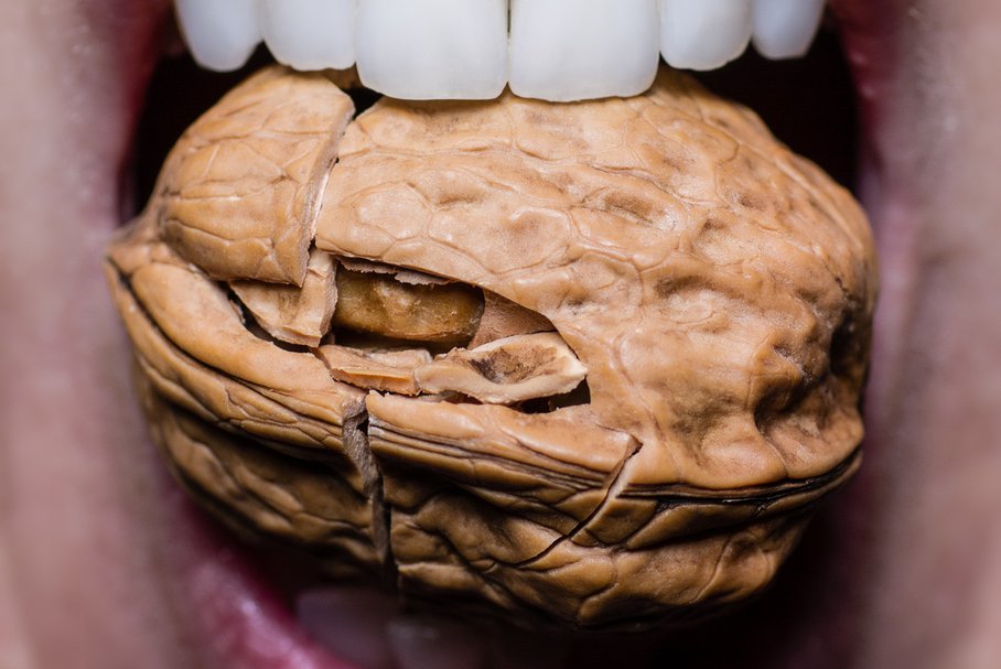 Złamany ząb – jak wygląda odbudowa zęba po złamaniu?