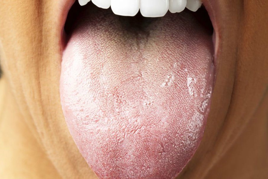 Zmiany W Jamie Ustnej Przyczyny Objawy Leczenie Zmian W Ustach Wylecz To