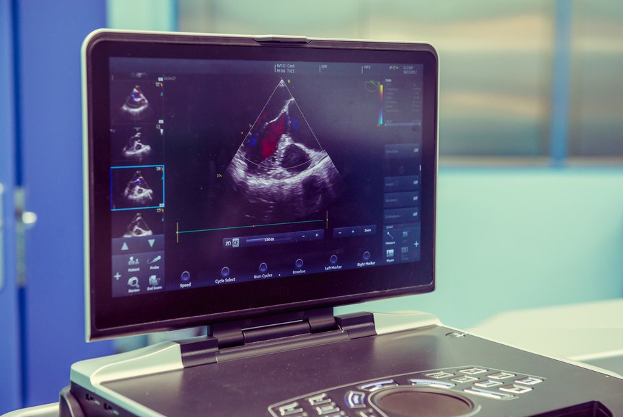 Ekran ultrasonografu.