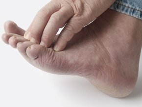 Porażenie nerwu strzałkowego – jakie są objawy, leczenie i rehabilitacja?