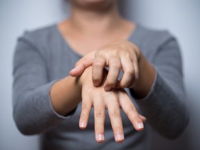 Jakim chorobom skóry towarzyszy objaw Koebnera?