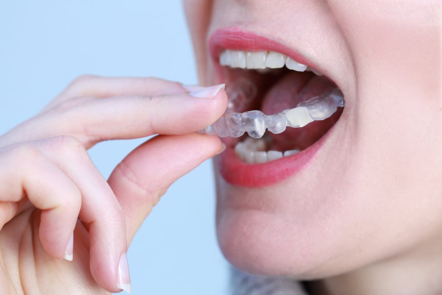 Zgrzytanie zębami podczas snu – przyczyny, leczenie